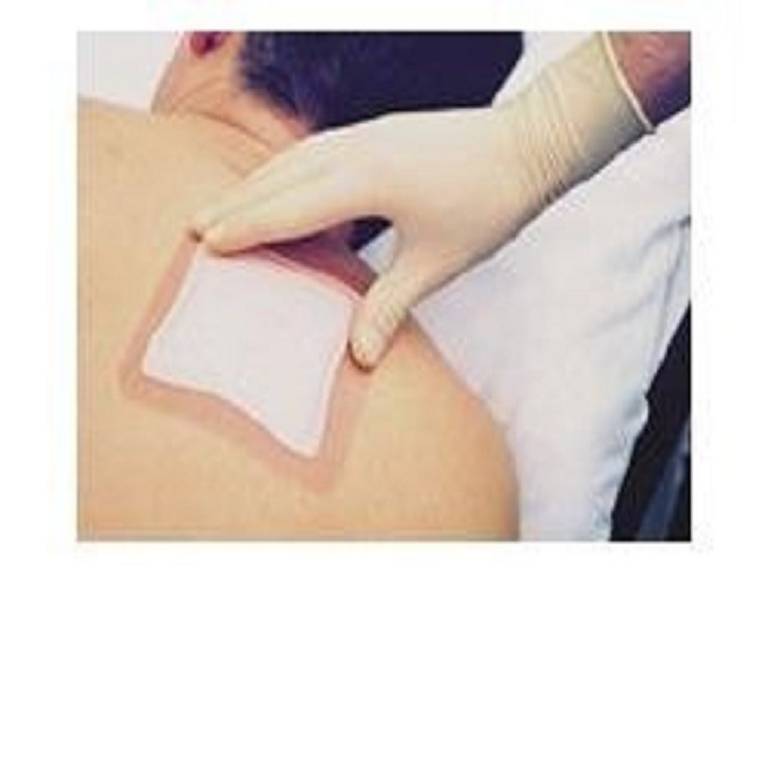 ALLEVYN ADHESIVE 12,5X12,5CM 3