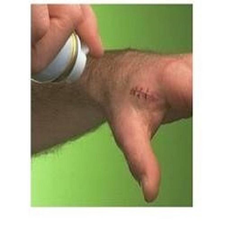 CER OPSITE SPRAY 240ML